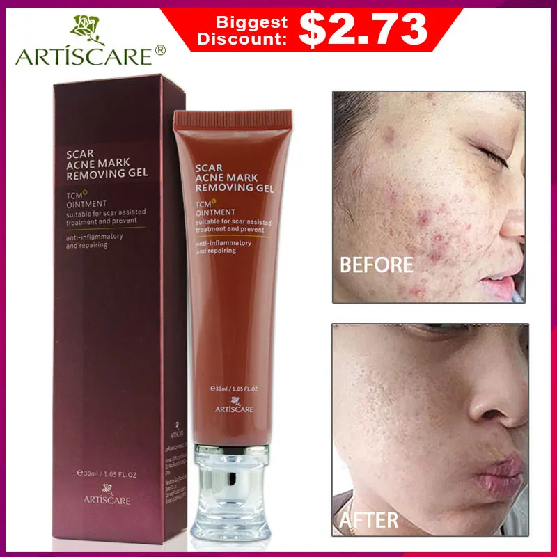 ARTISCARE ginseng extract against black dots cream scar removal facial blackhead acne skin care