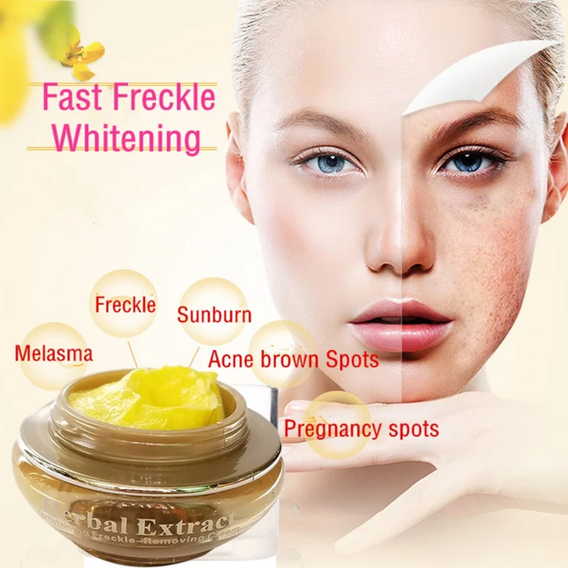 

3pcs Herbal Whitening Cream Set Removal Freckle melasma pigment Melanin Sunburn Pregnancy spots Acne brown Spots Beauty Cosmetic