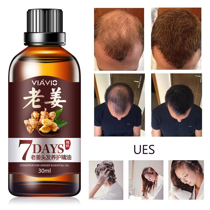 Мощная эссенция для роста волос продукты для выпадения волос имбирь жидкость для выпадения волос уход за здоровьем эссенция для волос масло 30 мл TSLM1