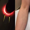 Portable Red LED Flashlight Vein Finder Tool Transilluminator Vein Viewer LB88 ► Photo 3/6