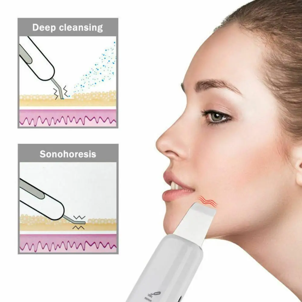 Ультразвуковая Зарядка для дома Глубокая очистка лица устройство для чистки красоты Аппарат для чистки кожи Scrubber экстрактор для пилинга