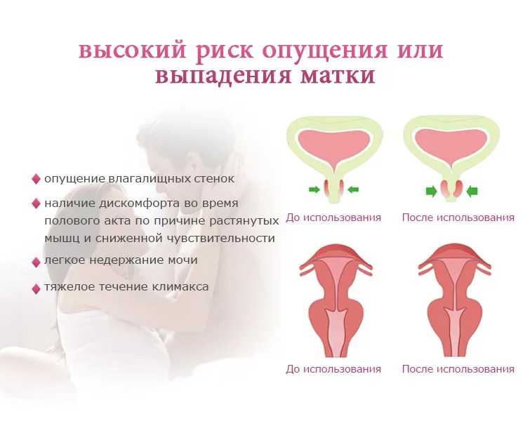 HTB1oO_8KFzqK1RjSZFvq6AB7VXaN