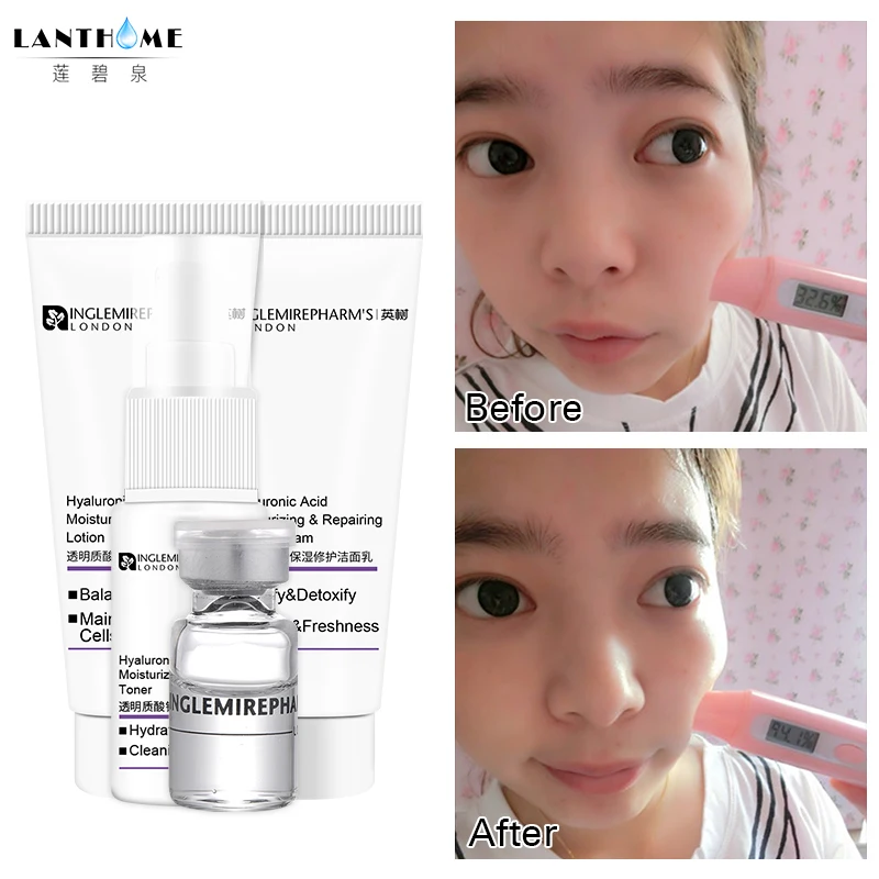 

Hyaluronic Acid Serum Facial Skin Care Set Anti Aging Wrinkle Moisturizing Nourishing Instant Face Lift Maintenance Snail Serum