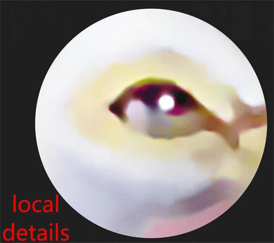 36020170908180151164