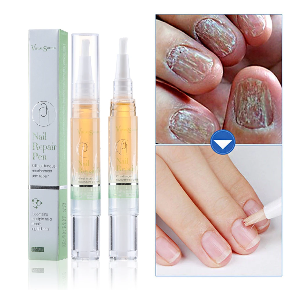 

5ml Fungal Nail Treatment Pen Effective Onychomycosis Paronychia Fungus Infection Repair Solution Gel Fingernails Toenails Care