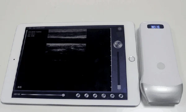 wireless linear probe