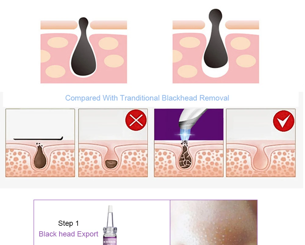 black head removal moisturising machine (5)