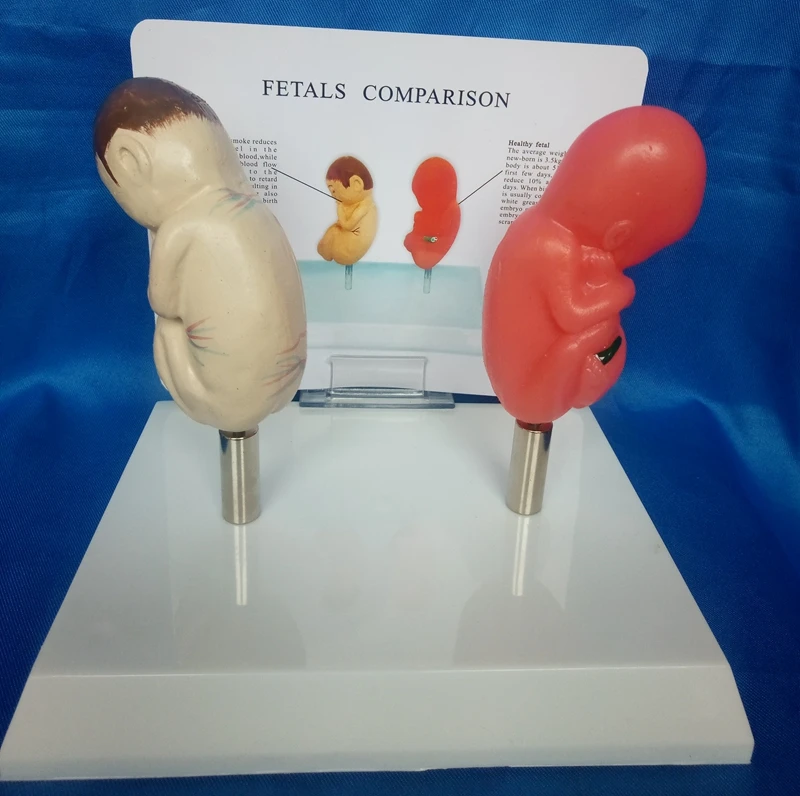 Fetals сравнение комплект для плода и нормальный fetals модель человеческого Средства ухода за кожей модель образования Медицинские товары преподавания