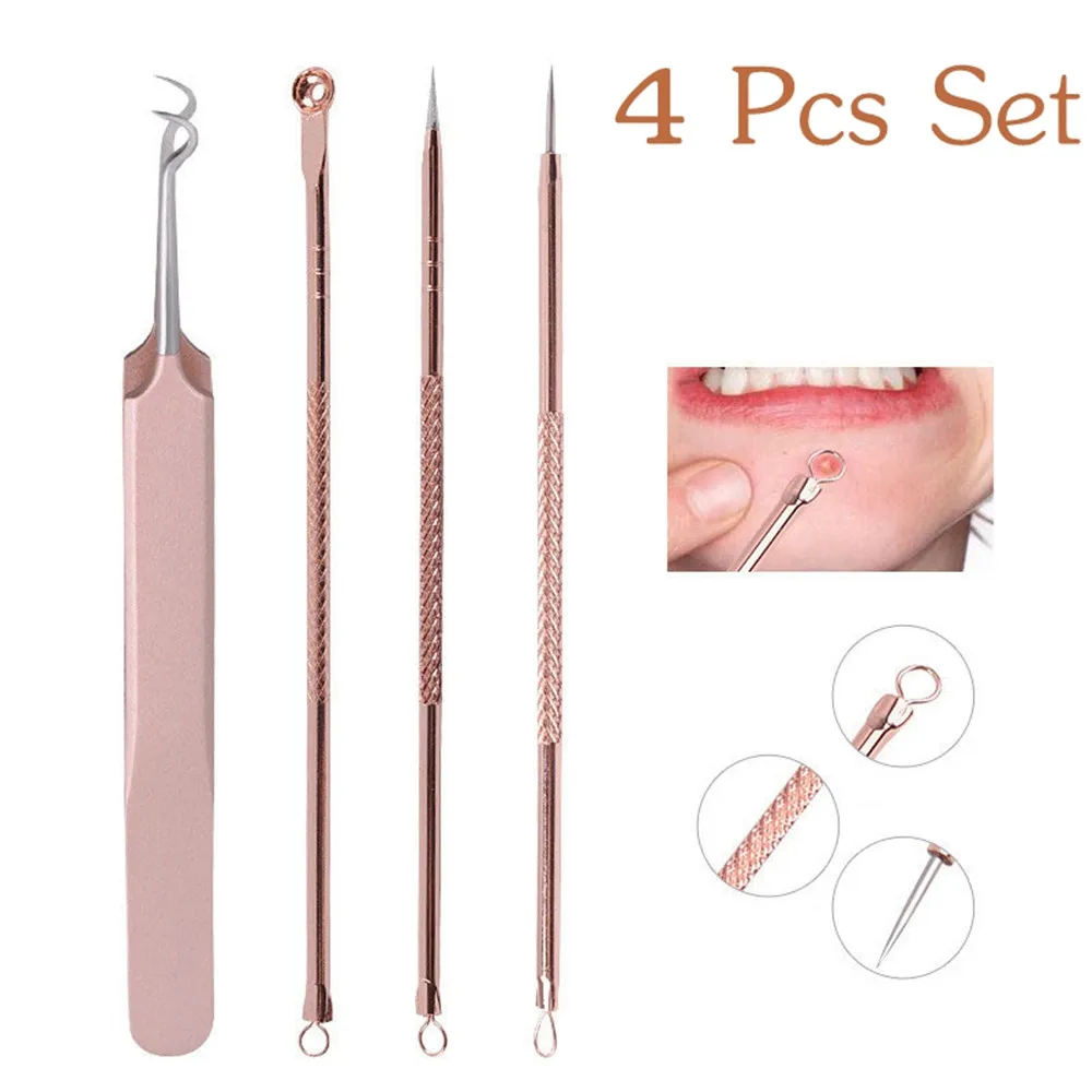 

4Pcs/Set Skin Care Blackhead Come Done Acne Blemish Pimple Extractor Remover Needles Cosmetic Face Cleaning Tool Rose Gold Color