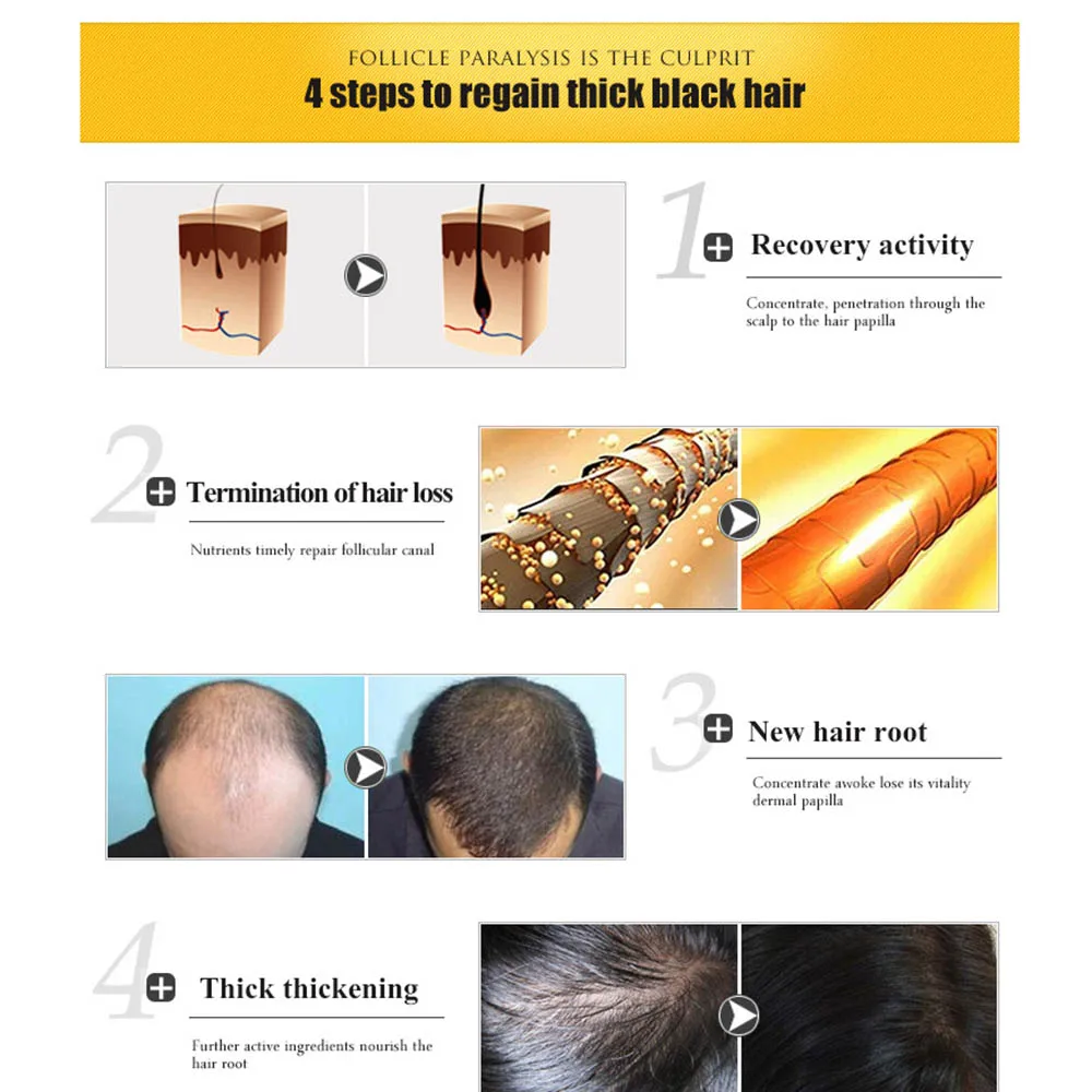 30 мл масло для роста волос увлажняющее питающее кожу головы гладкое сухое восстанавливающее лечение эссенция для ухода за волосами