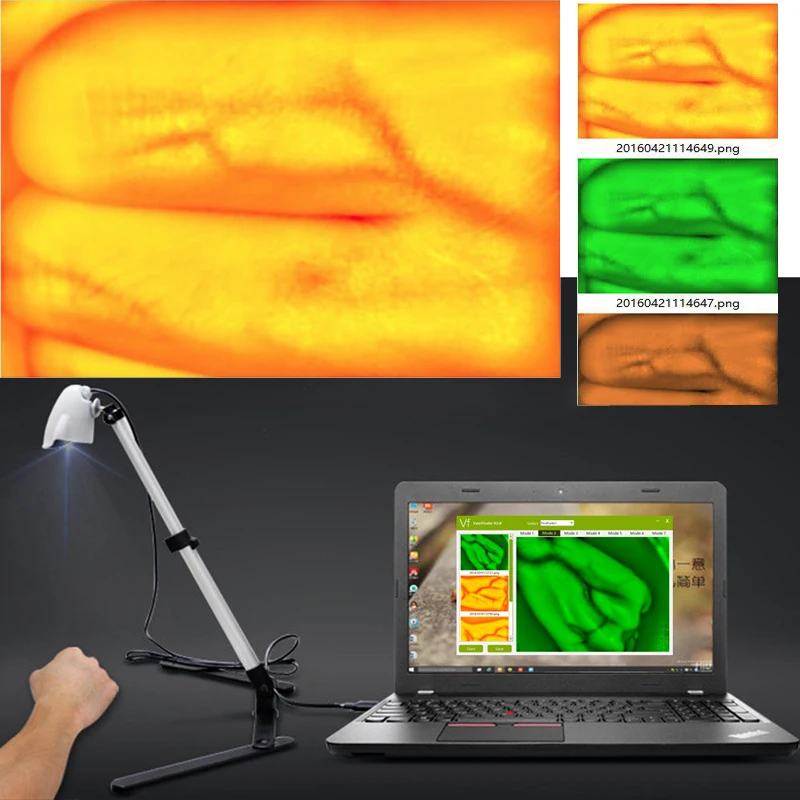 

Advanced Adjustable Adult Children Vein Viewer Display Infrared Lights USB Camera Imaging IV Medical Vein Finder