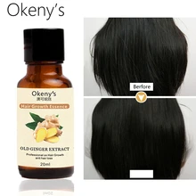 Мужское эфирное масло для выпадения волос, продукт для Crescimento De Cabelo Dsy, масло для выпадения волос, полностью против выпадения волос