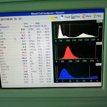 

CBC Blood cell counter 3 parts hematology analyser analyzer