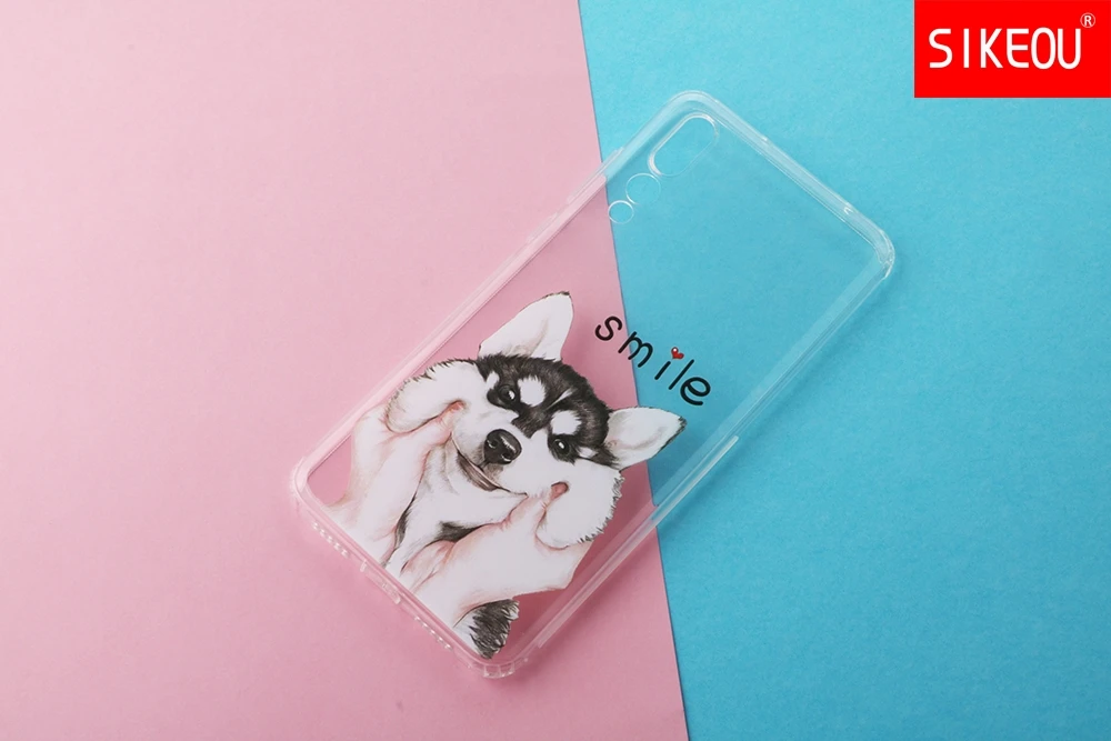 case for huawei P20 LITE case cover for huawei p20 pro case back cover silicon 360 full protective P 20 Lit Coque etui clear cat case for huawei P20 LITE case cover for huawei p20 pro case back cover silicon 360 full protective P 20 Lit Coque etui clear cat