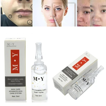 

5ML Mole & Skin Tag Repair Solution Painless Mole Skin Dark Spot Repair Face Wart Tag Freckle Repair Cream Oil D257