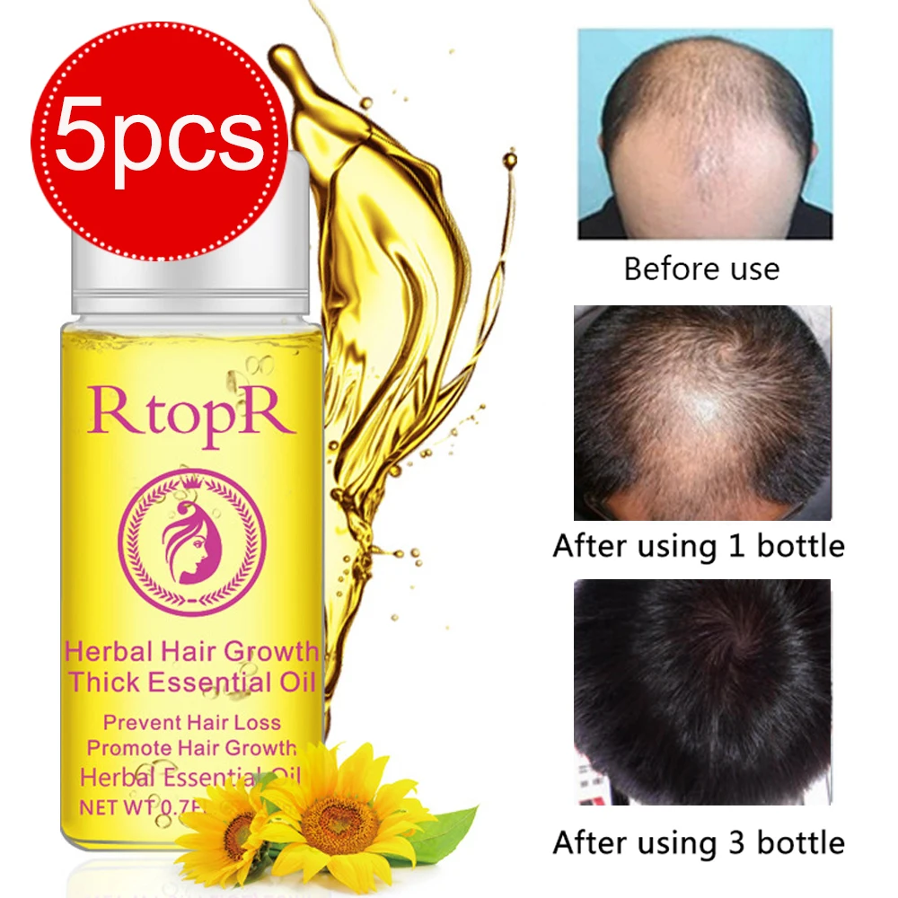 

RtopR 5pcs/set Anti Hair Loss Essential Oil Hair Growth Fast Herbal Thick Serum Professional Hair Care Fiber Liquid Beard Growth