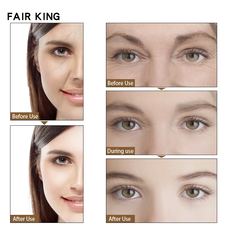 Argireline Collagen Peptides Youth Freeze Serum Face Cream Anti-Aging Wrinkle Lift Firming Whitening Moisturizing Skin Care Argireline Collagen Peptides Youth Freeze Serum Face Cream Anti-Aging Wrinkle Lift Firming Whitening Moisturizing Skin Care