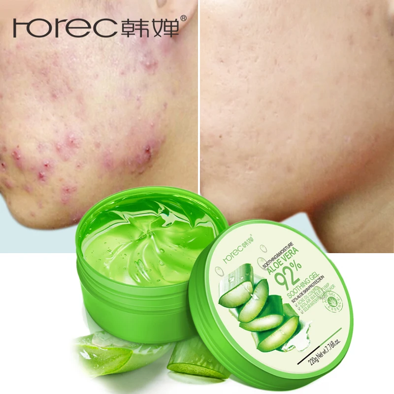 ROREC Natural алоэ вера гель крем для лица увлажняющий лечения акне увлажнение