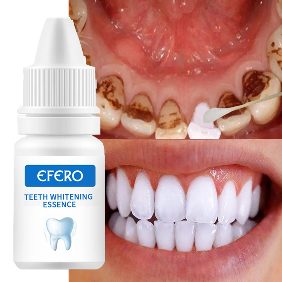 EFERO зубов отбеливающая сыворотка Удалить зубы Красители ярче желтый зуб улыбка гигиена полости рта Очищающая сыворотка отбеливающий