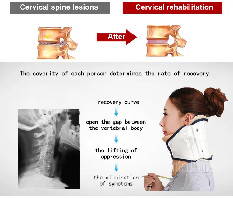 Cervical-spine-Brace(4)