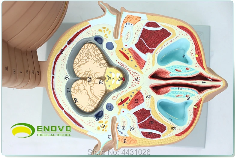 Эново мозговая трансекционная модель в медицине человека. Мозговой КТ МРТ мозговой магнитно-резонансной томографии