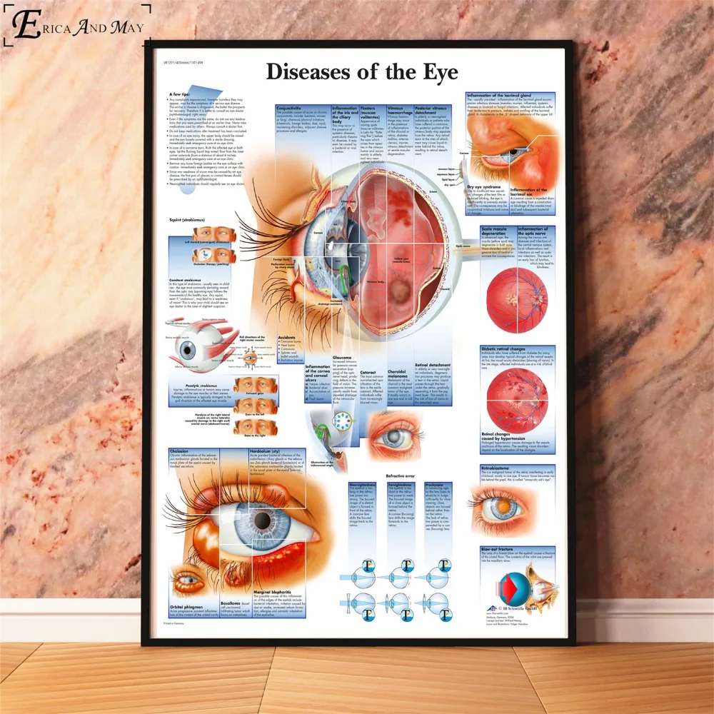 Анатомия болезни патологии диаграмма картина, печатный плакат декоративные настенные картины для комнаты без рамки украшения дома аксессуары
