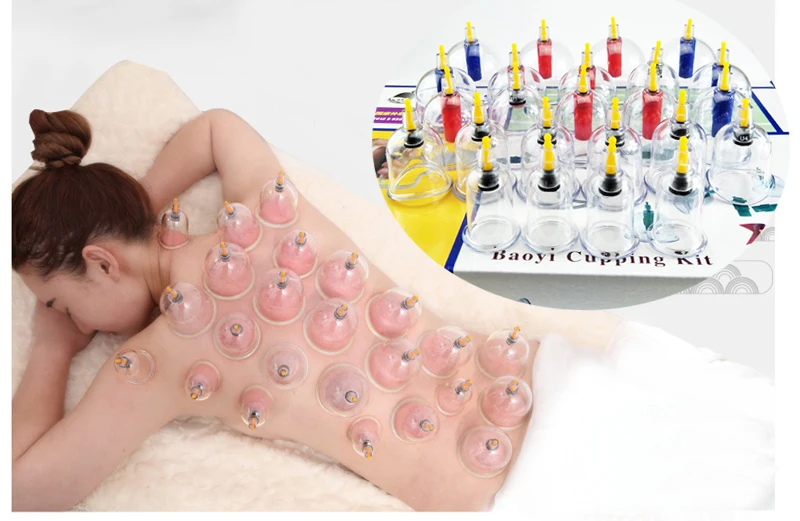 Cupping massage (10)