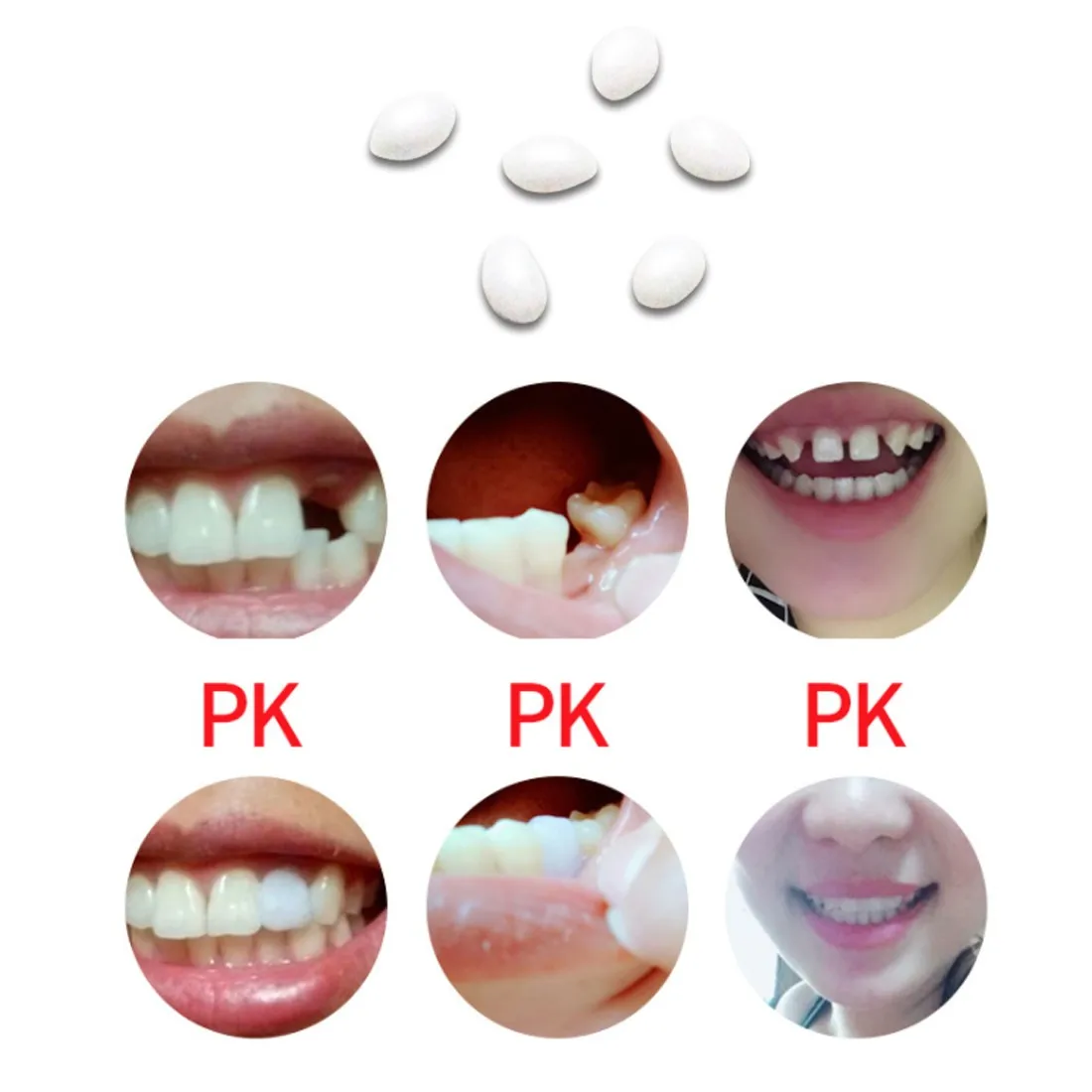 Временный набор для ремонта зубов и зазоров фалсетейные Твердые клеевые протезы Клей DIY протез твердый зубной гель здоровье 611