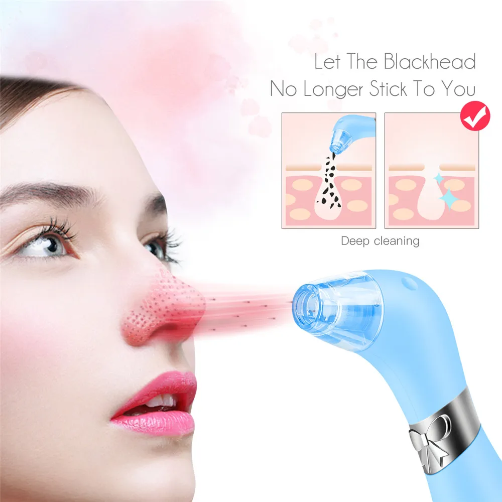 

CkeyiN Rechargeable Electric Acne Comedo Extractor Machine Blackhead Pore Remover Vacuum Suction Massager Facial Cleaner 46