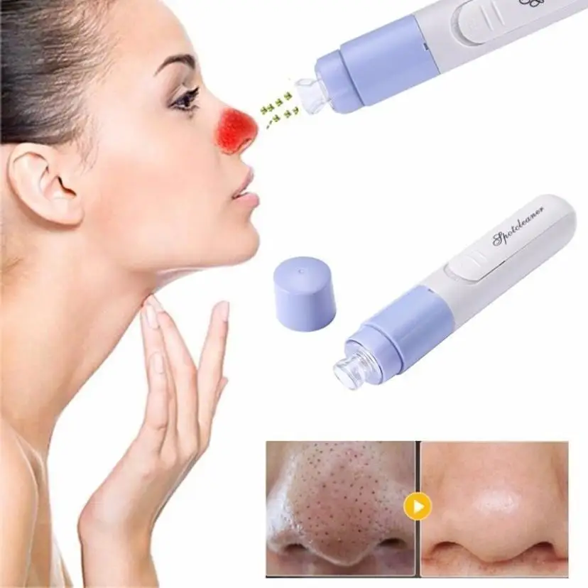 

Handheld Electric Blackhead Remover Cleaner Vacuum Suction Facia Blackhead Removal Skin Care Cleansing Tool in Massage Anne