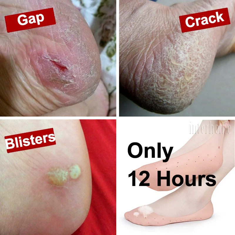 Gel-socks-PWZ030(15)