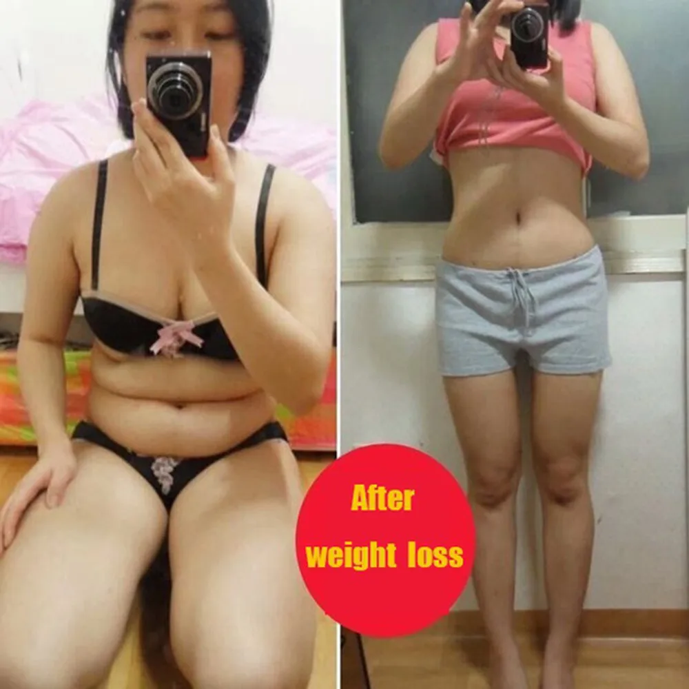 

Foot Care Tool Reduce weight 4 PCS Slimming Health Silicon Magnetic Foot Massager Massge relax Toe Ring P#