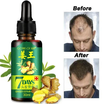 

5pcs/set Fast Powerful Liquid Treatment Preventing Hair Loss Anti Hair Loss Hair Growth Liquid Serum Essential Oil for Men Women