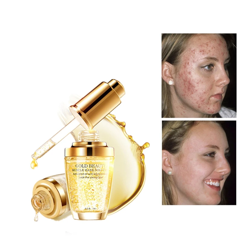 

24K Gold Collagen Essence Skin Care Brighten Serum Hyaluronic Acid Face Cream Remover Freckle Spots Whitening solution 30ml