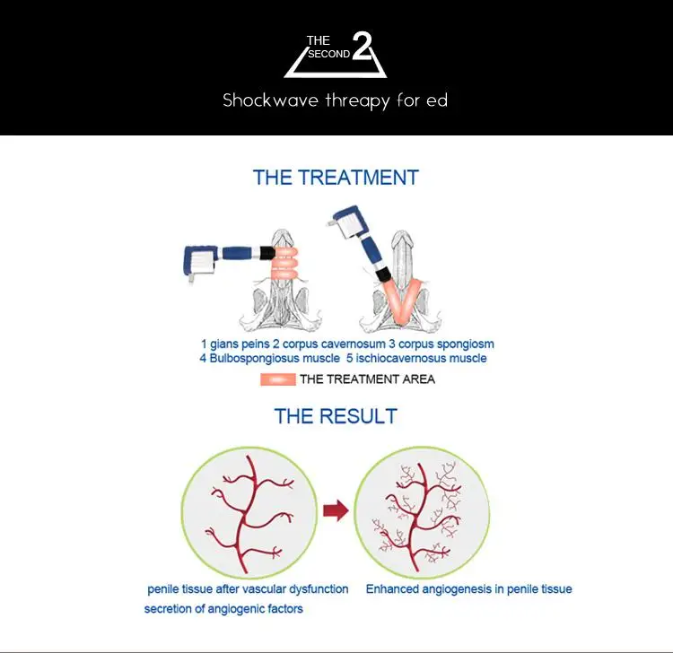 Высокое качество shockwave терапия машина для ударной волны для похудения снижение боли ED эрекция лечение дисфункции