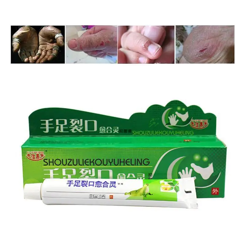 Chinese Medicinal Ointment Cream Hand Foot Crack Cream Heel Chapped Peeling Repair Frostbite Anti Dry Crack Skin Creams U3
