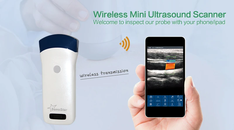 

Convex Series(Convex & Linear) Wireless Probe Type Ultrasound Scanner