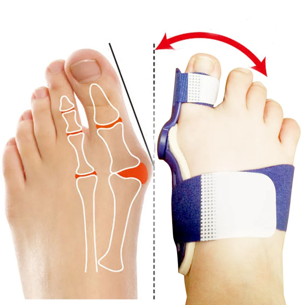 Bunion шина выпрямитель для большого пальца ноги устройство для вальгусной деформации ортопедические подтяжки коррекция носка корректор для ухода за ногами большой палец