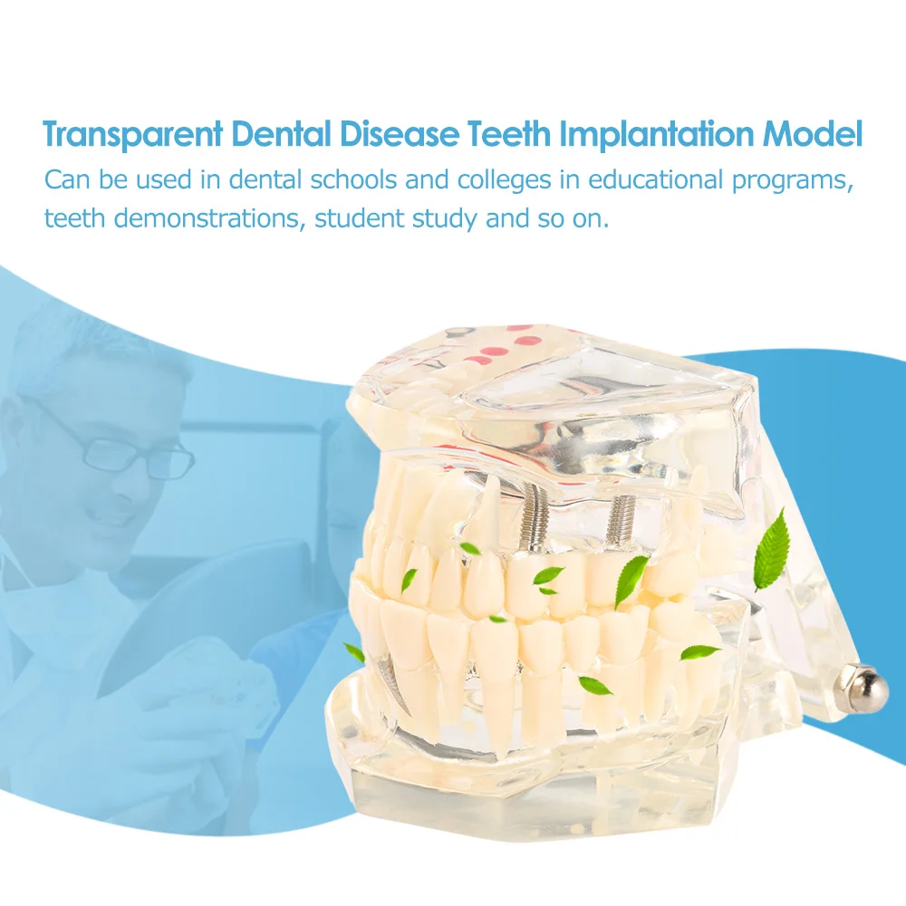 

Transparent Dental Implantation Disease Teeth Model Teaching Teeth Tool Dental Adult Typodont Removable Teeth Model
