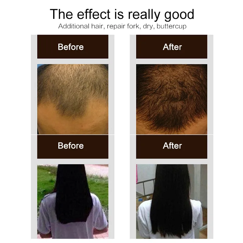 PURC Горячая Мода 30 мл спрей для роста волос экстракт предотвращает выпадение волос растущие волосы для мужчин экстракт имбиря лечение роста кожи головы