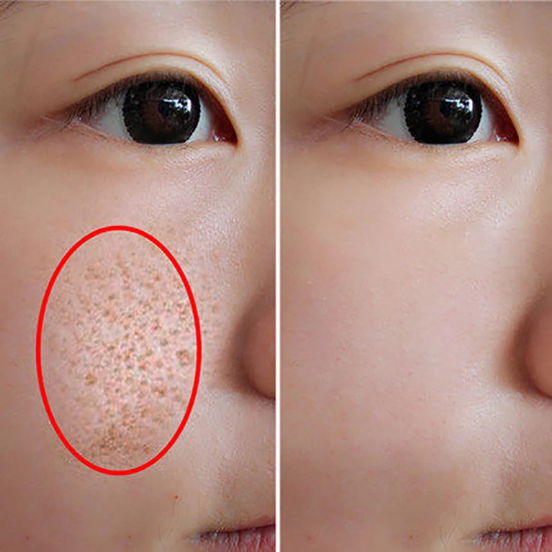 

Vitamin B5 hyaluronic acid Liquid Serum Moisturizing Shrink pore Anti Wrinkle Skin Whitening Facial Essence Skin Face Care