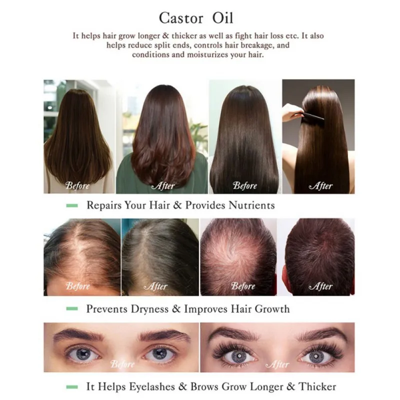 Натуральный рост волос эфирное масло ролик органический удлинитель ресниц сыворотка для роста предотвращает старение кожи уход за телом черный касторовое масло для