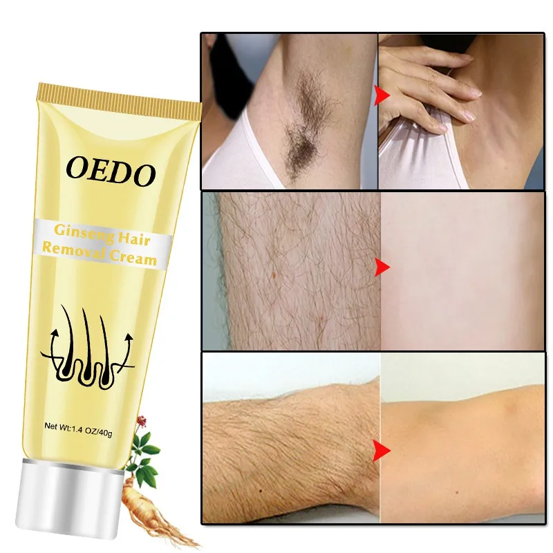 New Ginseng Body Hair Removal Cream for Men and Wo