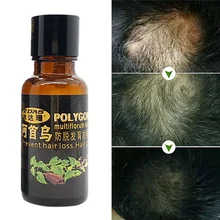 Andrea анти-выпадение волос эссенция выпадения волос жидкость 20 мл густой волос Горец многоцветковый мужской и женский волос растет основной продукт