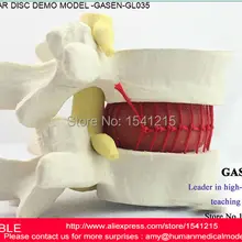 Человеческая поясница, дисковая грыжа, демонстрационная модель, поясничная модель, ортопедическая модель позвоночника, Мужская ортопедическая модель позвоночника, модель GASEN-GL035