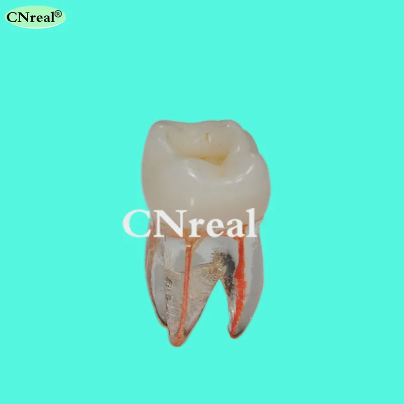 3 шт./лот зуб корневой канал зубы модель для RCT практики прозрачная смола с целлюлозной полости и окрашенный корневой канал
