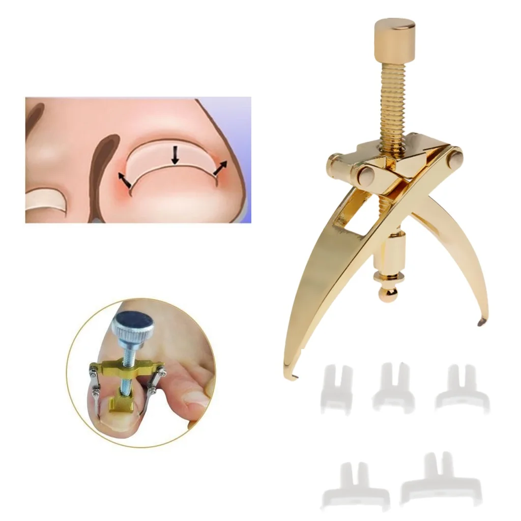 Cena Wrastające narzędzie do korekcji paznokci Manicure Clipper Pedicure Fixer Recover Tool wysokiej jakości stop i plastik zestaw narzędzie do Manicure