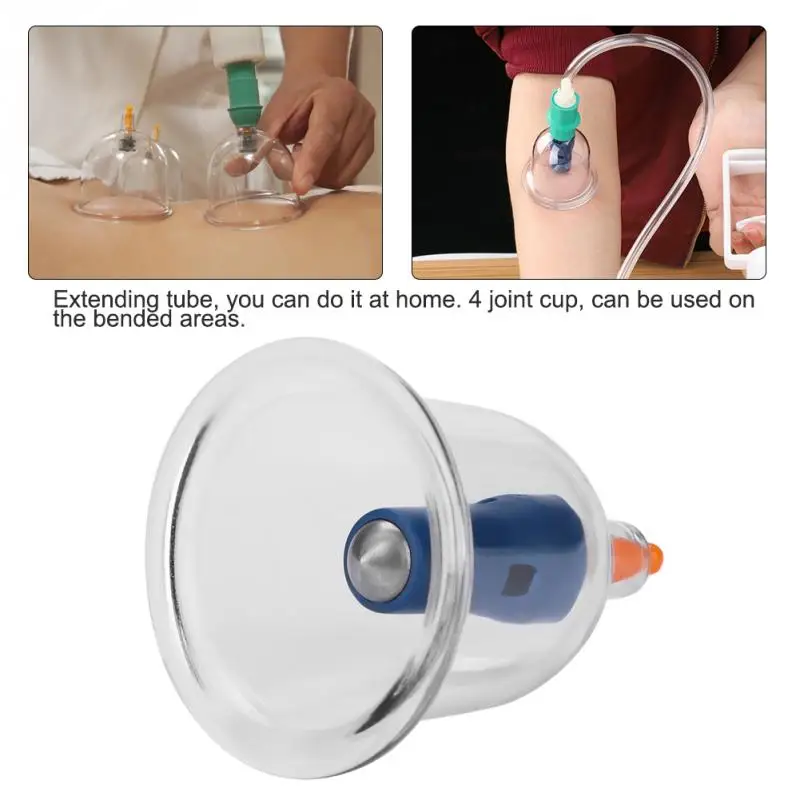 12PCs U-shape Body Suction Cups Chinese Vacuum Cupping Set Body Lymph Drainage Massage Slimming Cupping Therapy Acupuncture Kits 12PCs U-shape Body Suction Cups Chinese Vacuum Cupping Set Body Lymph Drainage Massage Slimming Cupping Therapy Acupuncture Kits