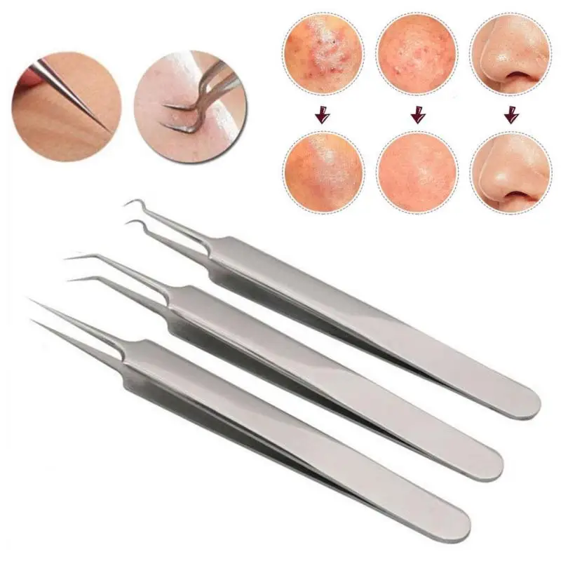 blackhead extractor tool bobby pin blackhead extractor tool bobby pin