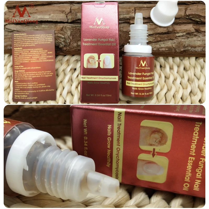 Lavender Fungal Nail Treatment Essential Oil Nail Art & Tools Promote Nails Grow Healthy Nail Treatment Onychomycosis Foot Care Lavender Fungal Nail Treatment Essential Oil Nail Art & Tools Promote Nails Grow Healthy Nail Treatment Onychomycosis Foot Care